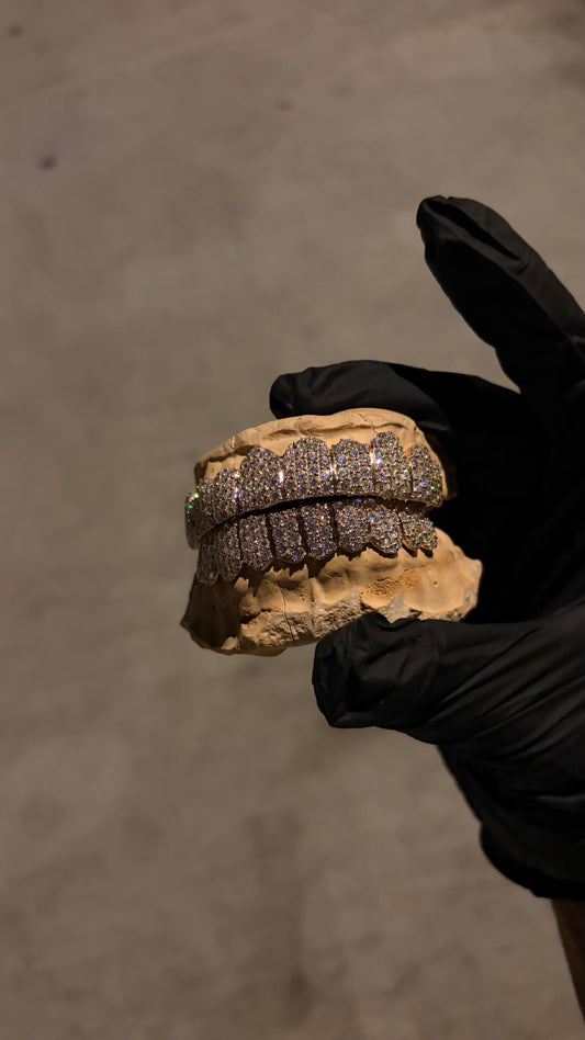 Iced out custom bussdown grillz